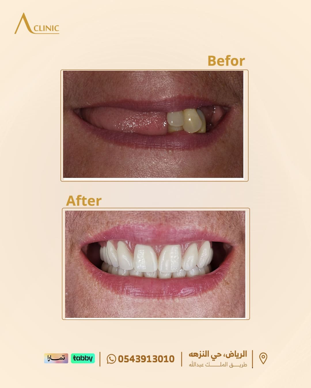 حالات-عادل-سلام.png1