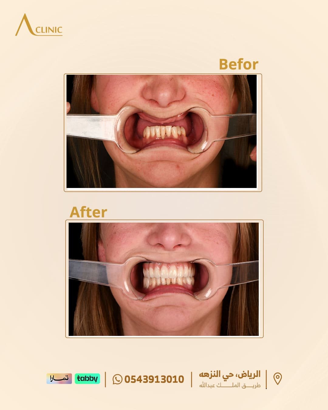 حالات-عادل-سلام.png2