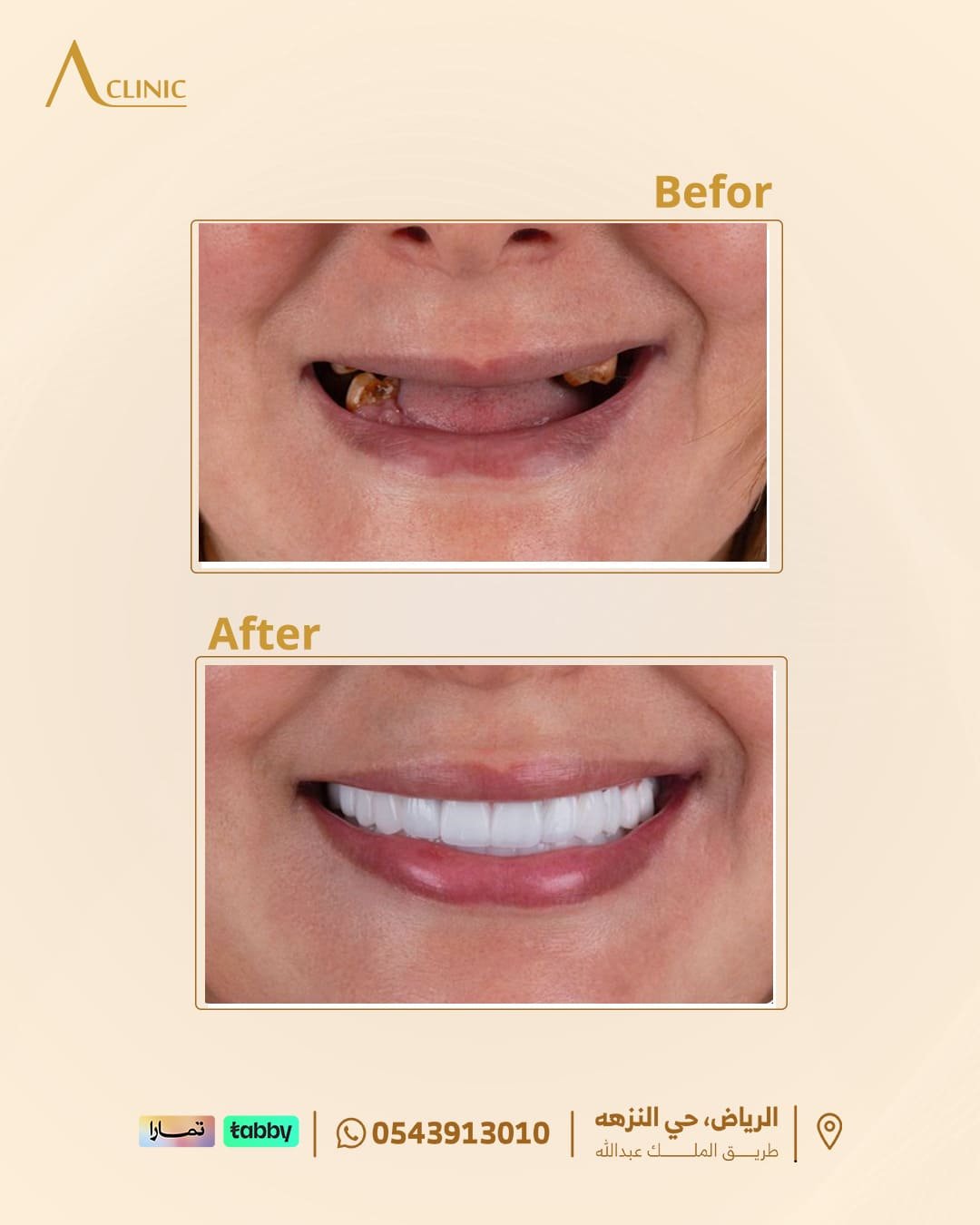 حالات-عادل-سلام.png3