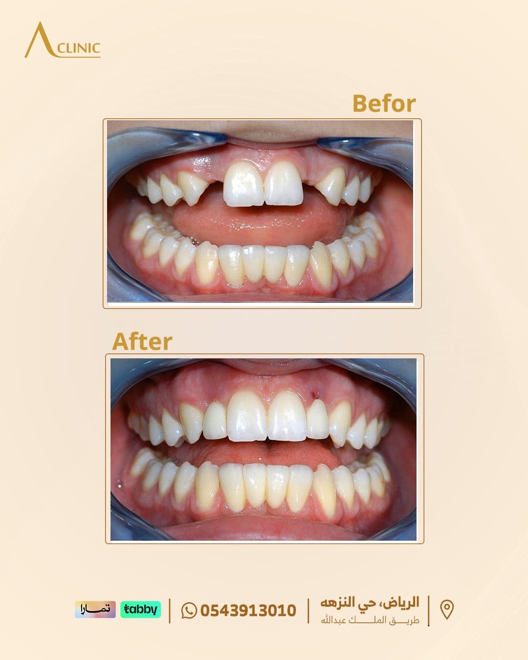 حالات-عادل-سلام.png4