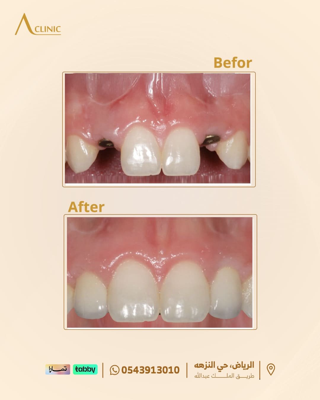 حالات-عادل-سلام.png5