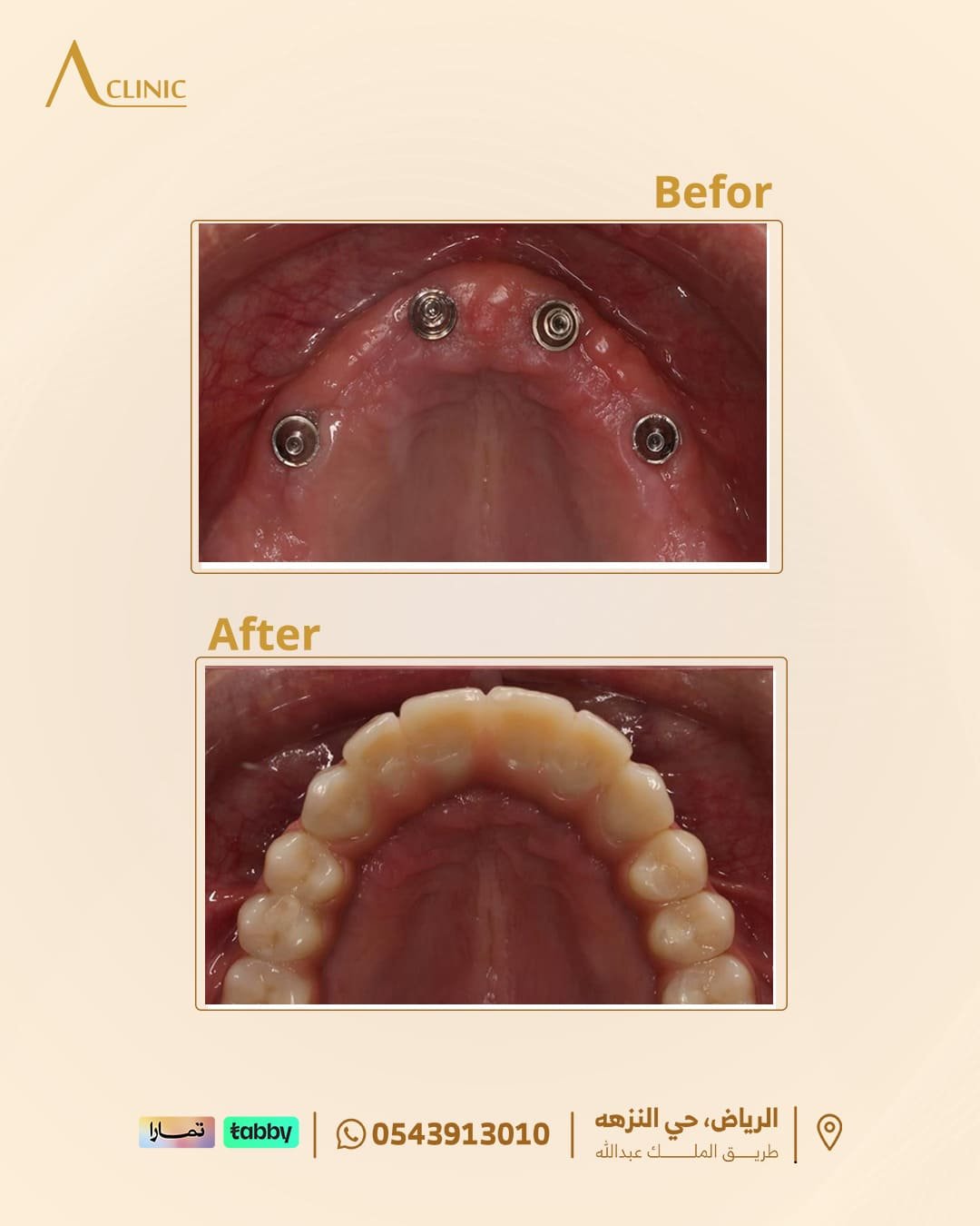 حالات-عادل-سلام.png6