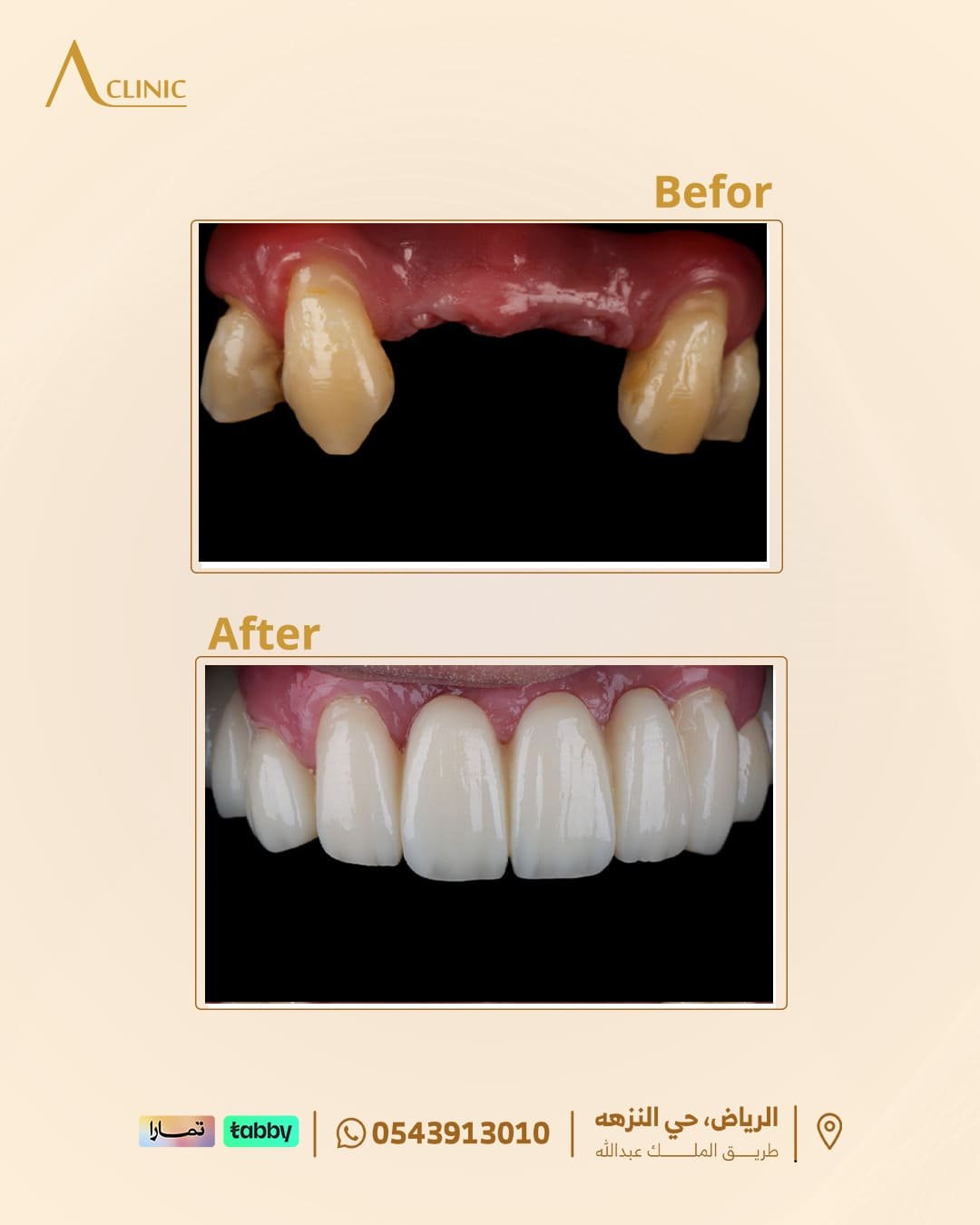 حالات-عادل-سلام.png7